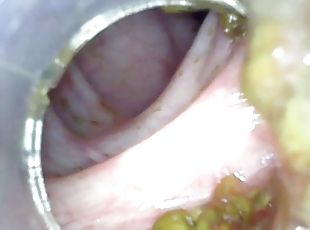 Deep deep anal again home colonoscopy endoscope part 1